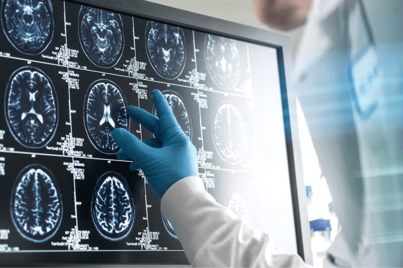 Business Insider: AI is fueling transformative new brain-health technology to detect and prevent cognitive decline